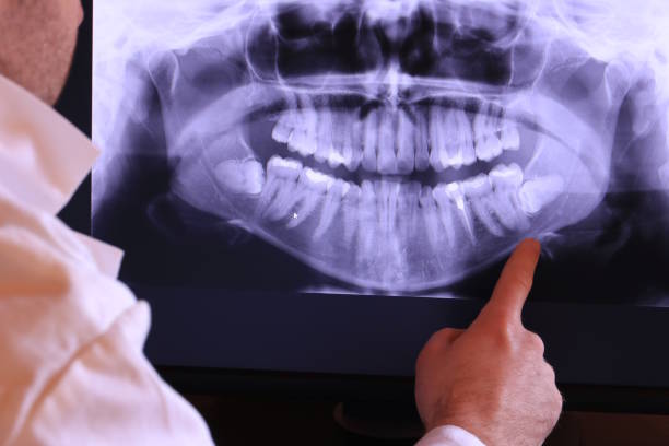 Best Broken or Chipped Tooth Repair in West Islip, NY